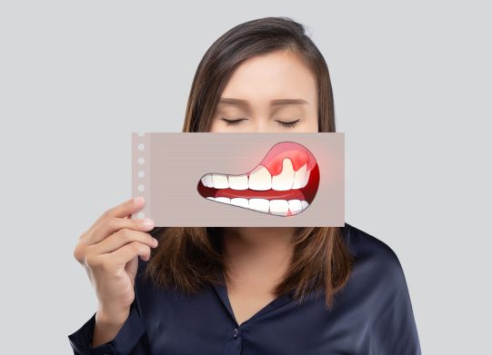 Asian woman in the dark blue shirt holding a paper with the periodontal and gingivitis cartoon picture of his mouth against the gray background, Decayed tooth, The concept with healthcare gums and teeth